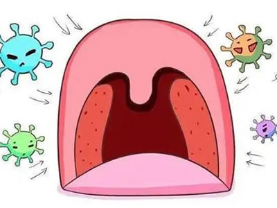 【儿科科普】儿童扁桃体发炎该不该切除？